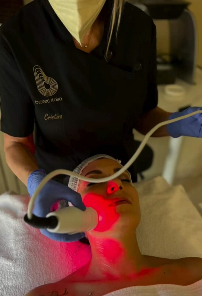 Trattamenti viso a Cuneo: Filler X