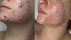 Trattamenti-viso-a-Cuneo-Empathie-al-tuo-servizio