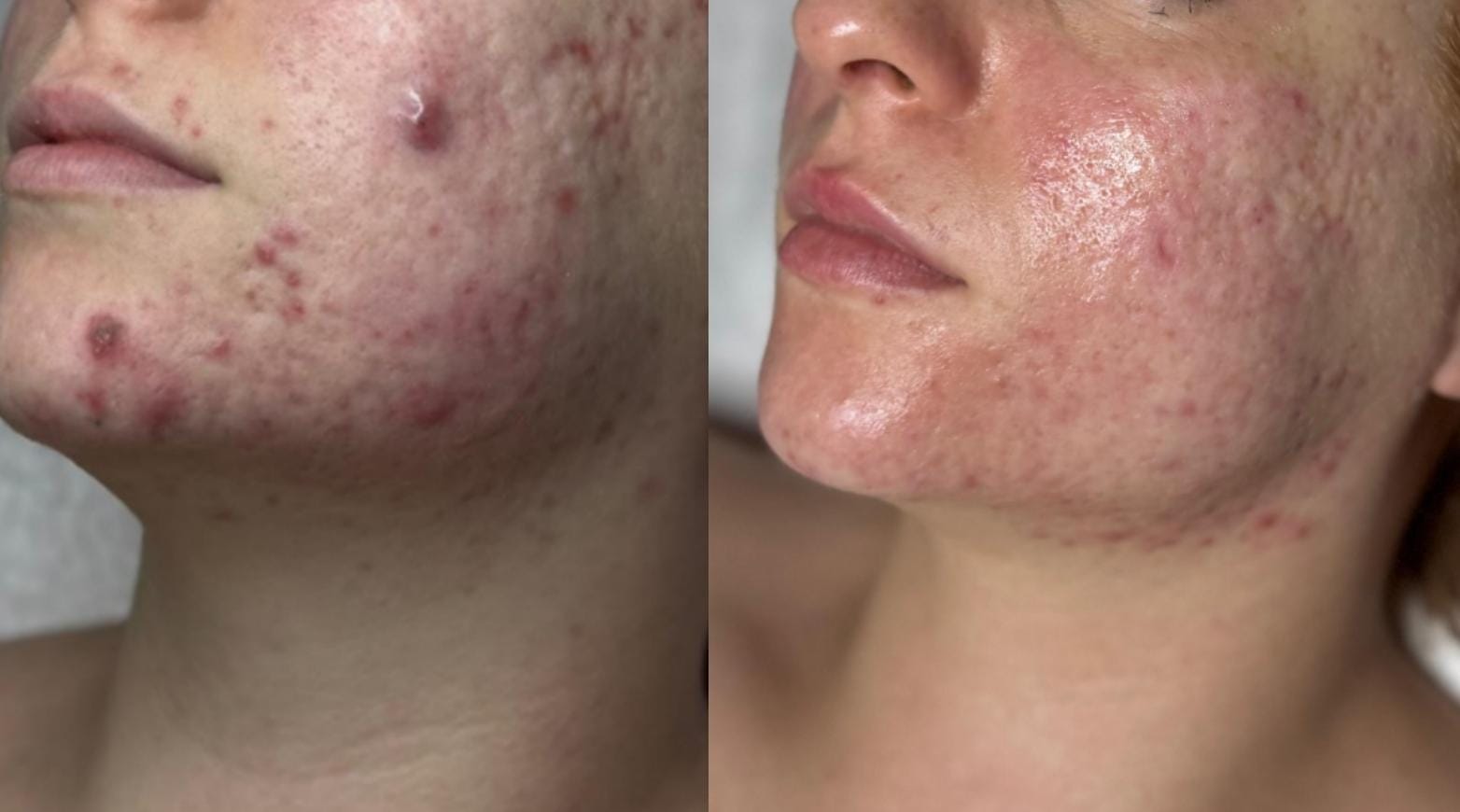 Trattamenti-viso-a-Cuneo-Empathie-al-tuo-servizio