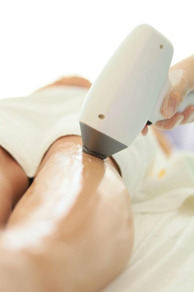 epilazione laser uomo a Cuneo